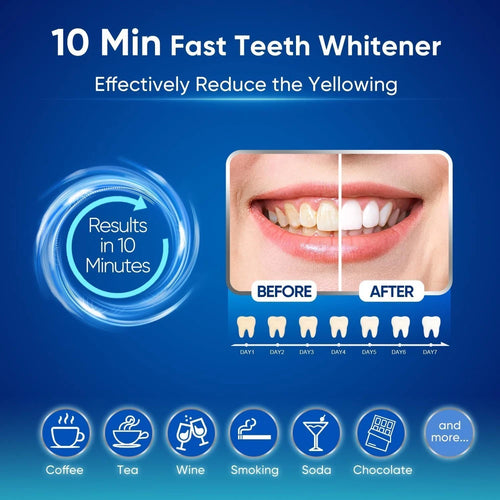 MySmile LED Teeth Whitening Kit